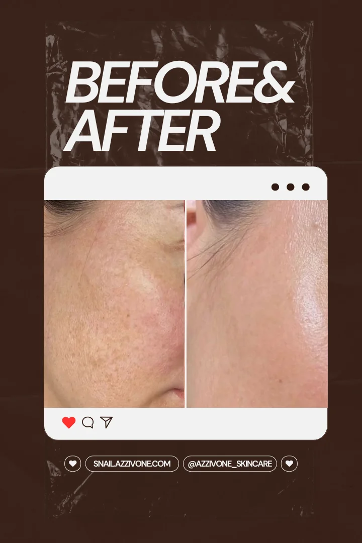 Transformation 4